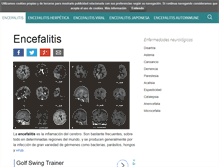 Tablet Screenshot of encefalitis.org